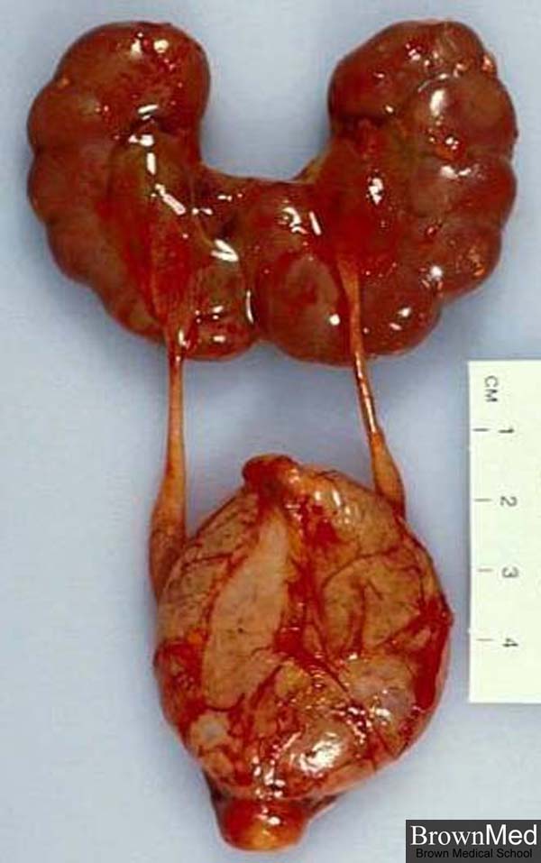 poles of kidney