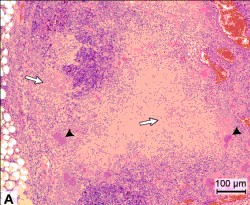 Lymph node