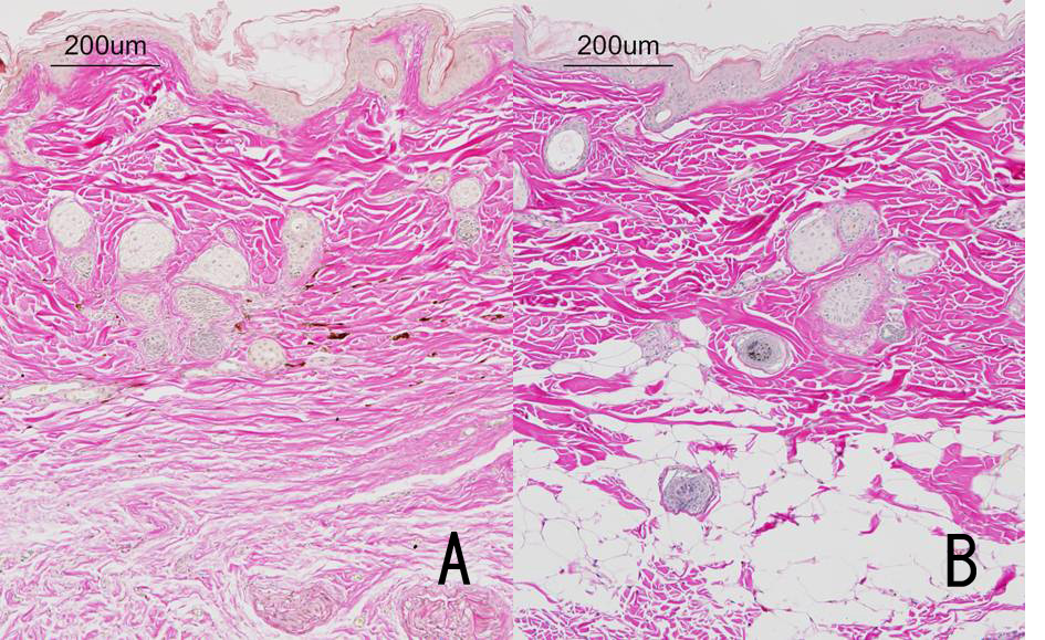 Adrenal cortex