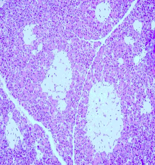 pancreas histology