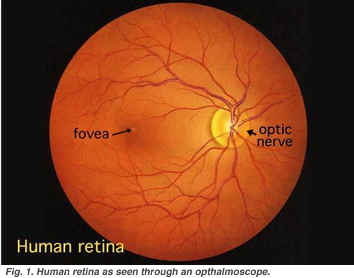 Retina Specialists Seattle, Retina Doctor Seattle 
