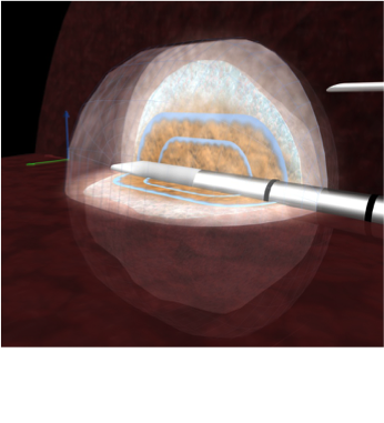 Simulation of heat over time