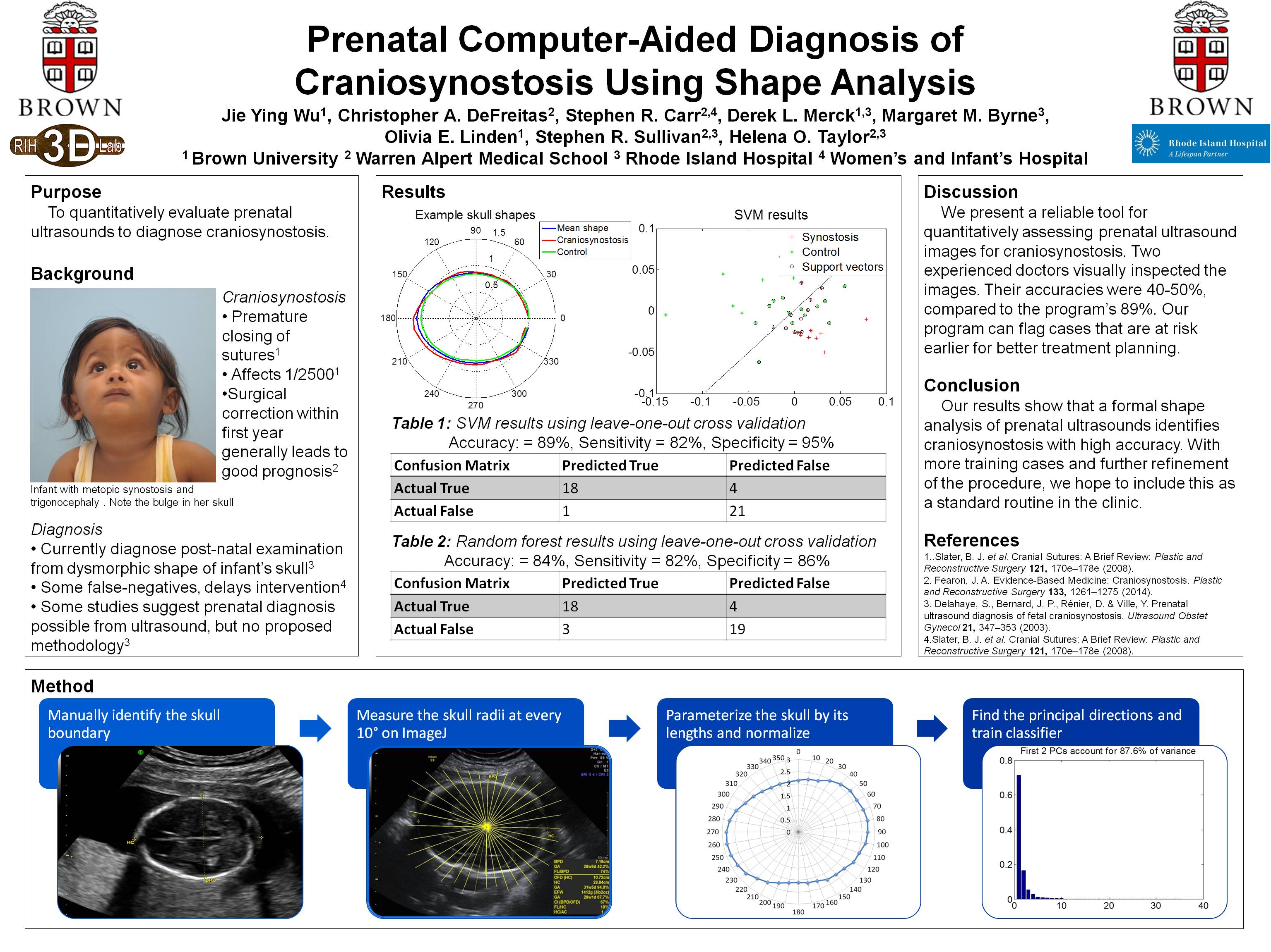 Prenatal Computer-Aided Diagnosis of Craniosynostosis Using Shape Analysis

