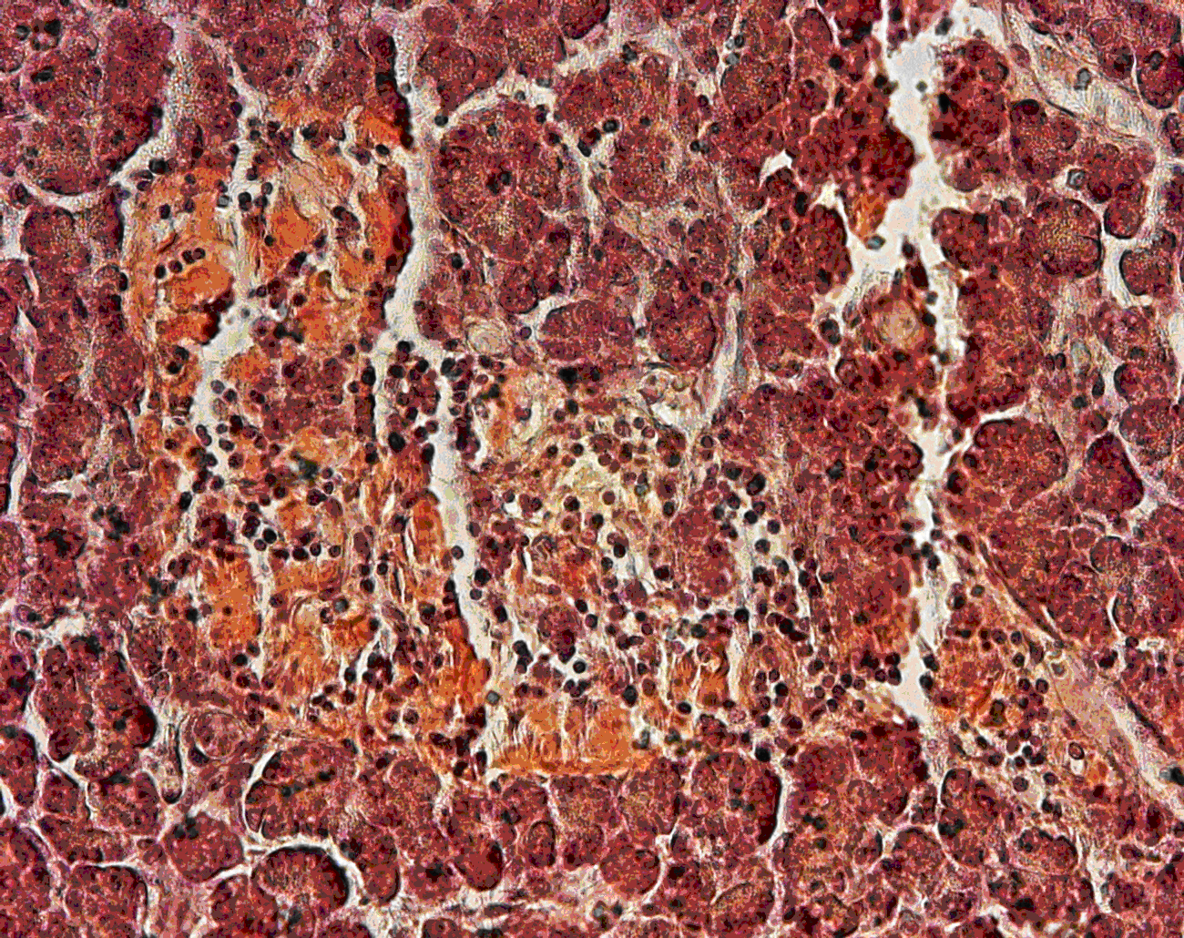 pancreas3