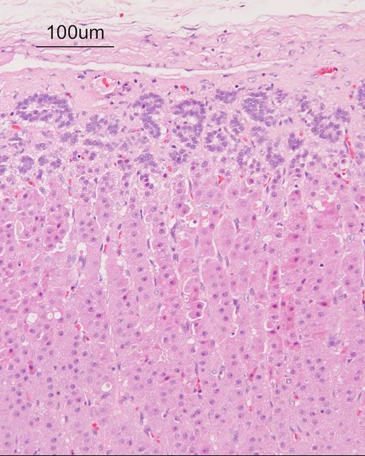 Adrenal cortex