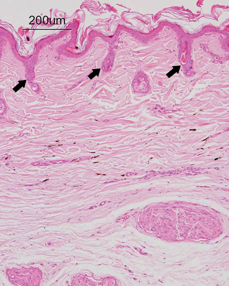 Adrenal cortex