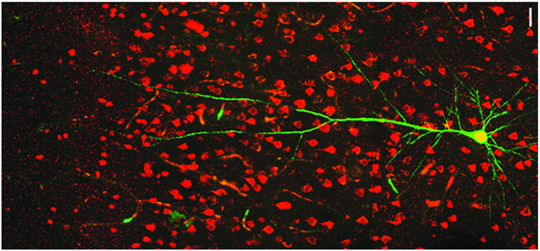 CARNEY.Neurons.liu.jpg