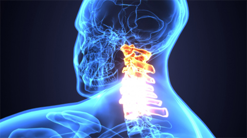 Spinal column heat image