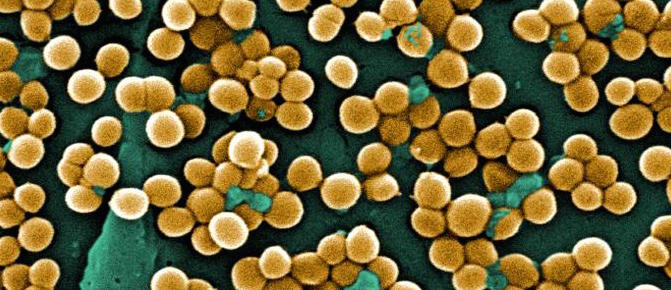 Magnified image of green and yellow Staph bacteria