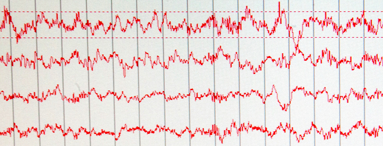 Brainwaves printout