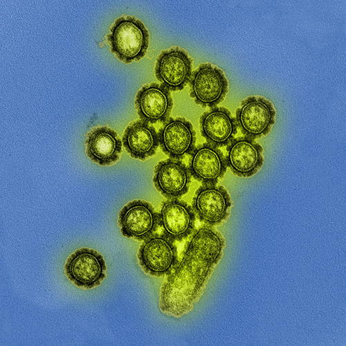 H1N1 virus under microscope