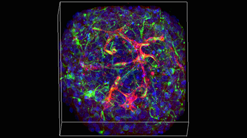 Fluorescent colored blood vessels