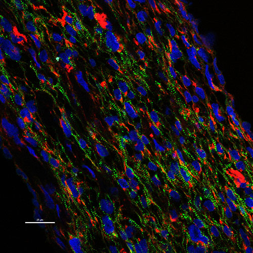 non-embryonic stem cell