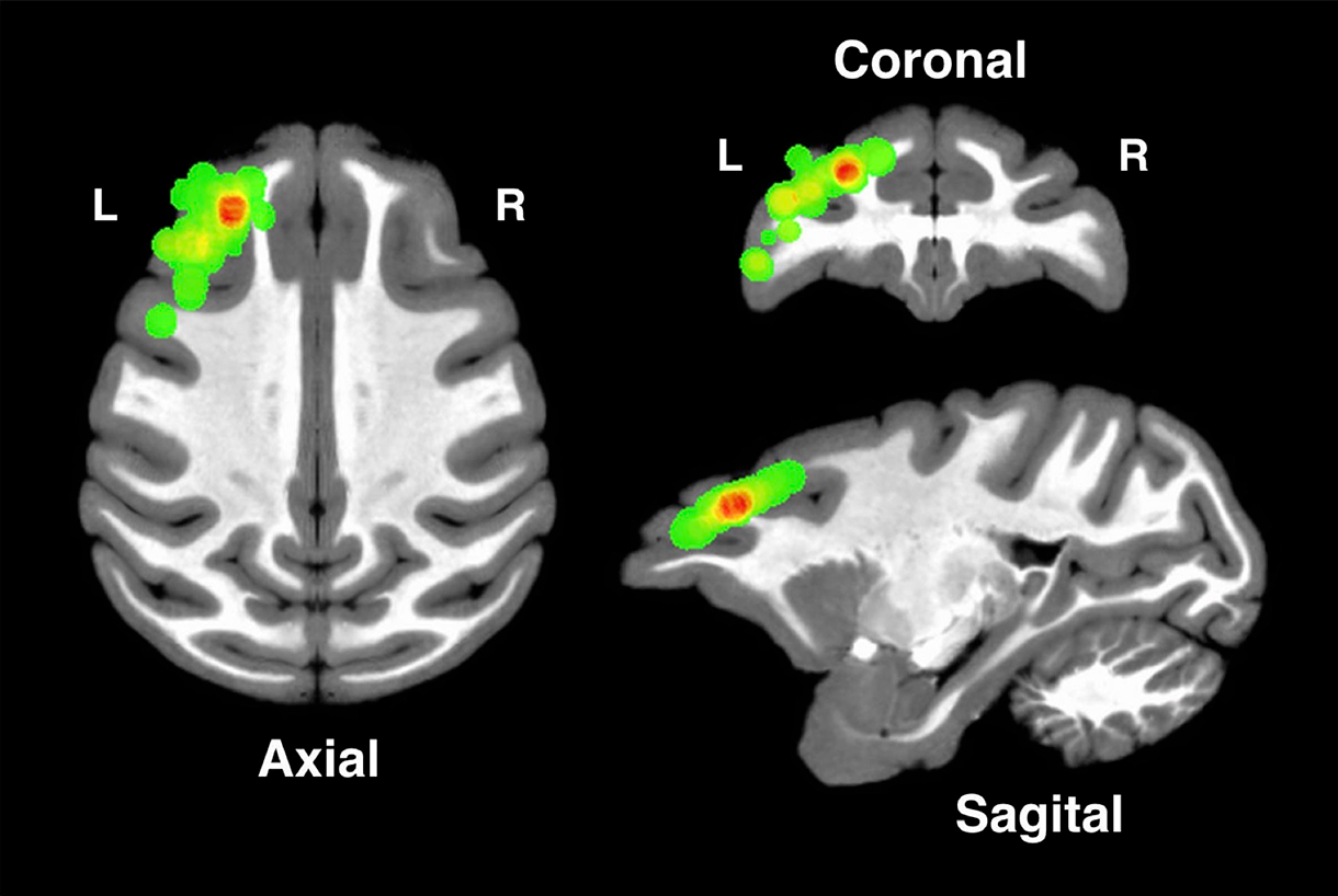 Brain images from different angles