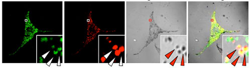 key proteins in the melanosome 