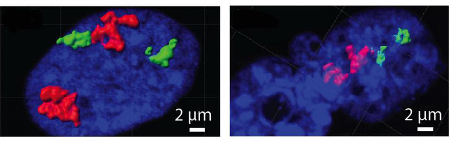 Chromosomes