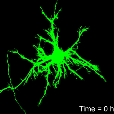 Animation of neuron death progression