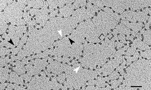 Electron micrograph of DNA with nucleosomes