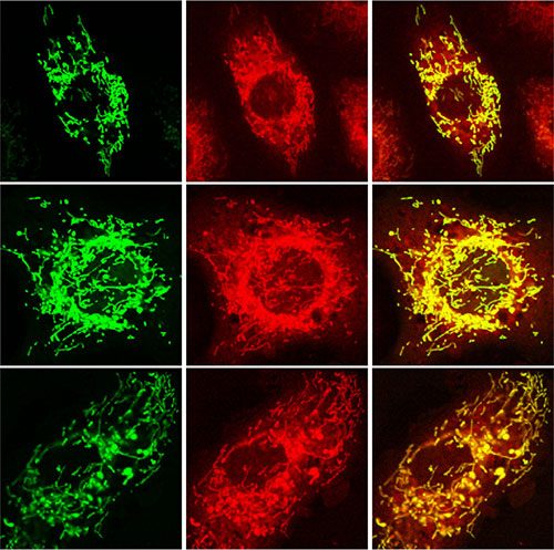 Sirt4 in mitochondria