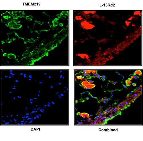 Fluorescently stained Images