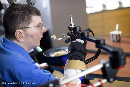 a Cleveland man with quadriplegia