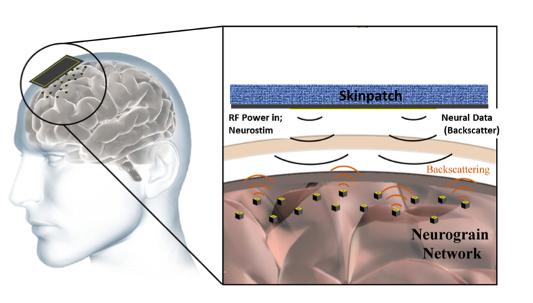 Diagram of neurograin network