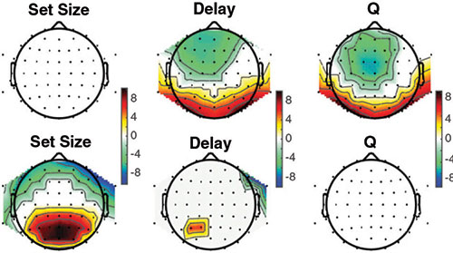 Brain Scans