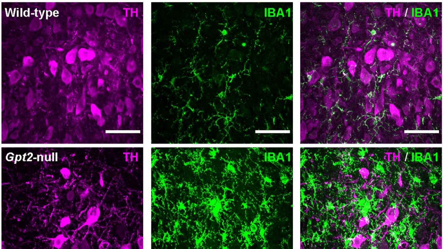 Researchers discover how a brain area implicated in Alzheimer’s may be ...