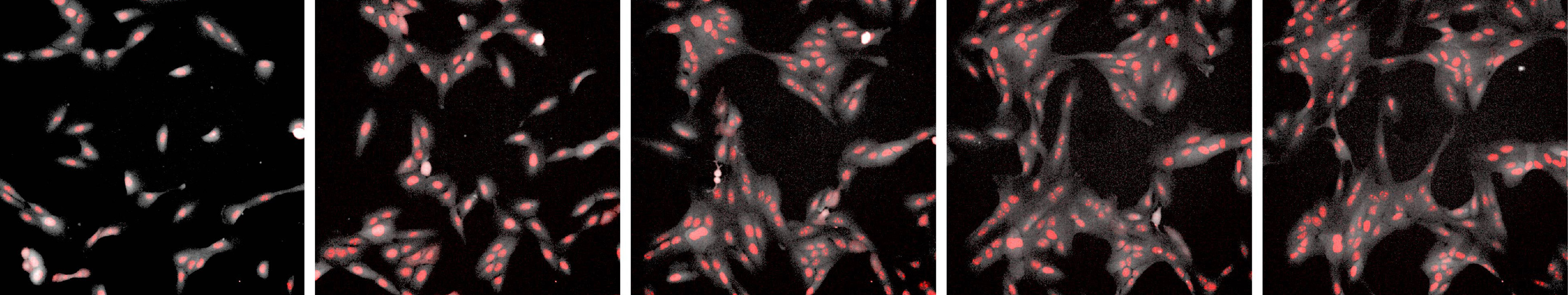 Cells in a petri dish