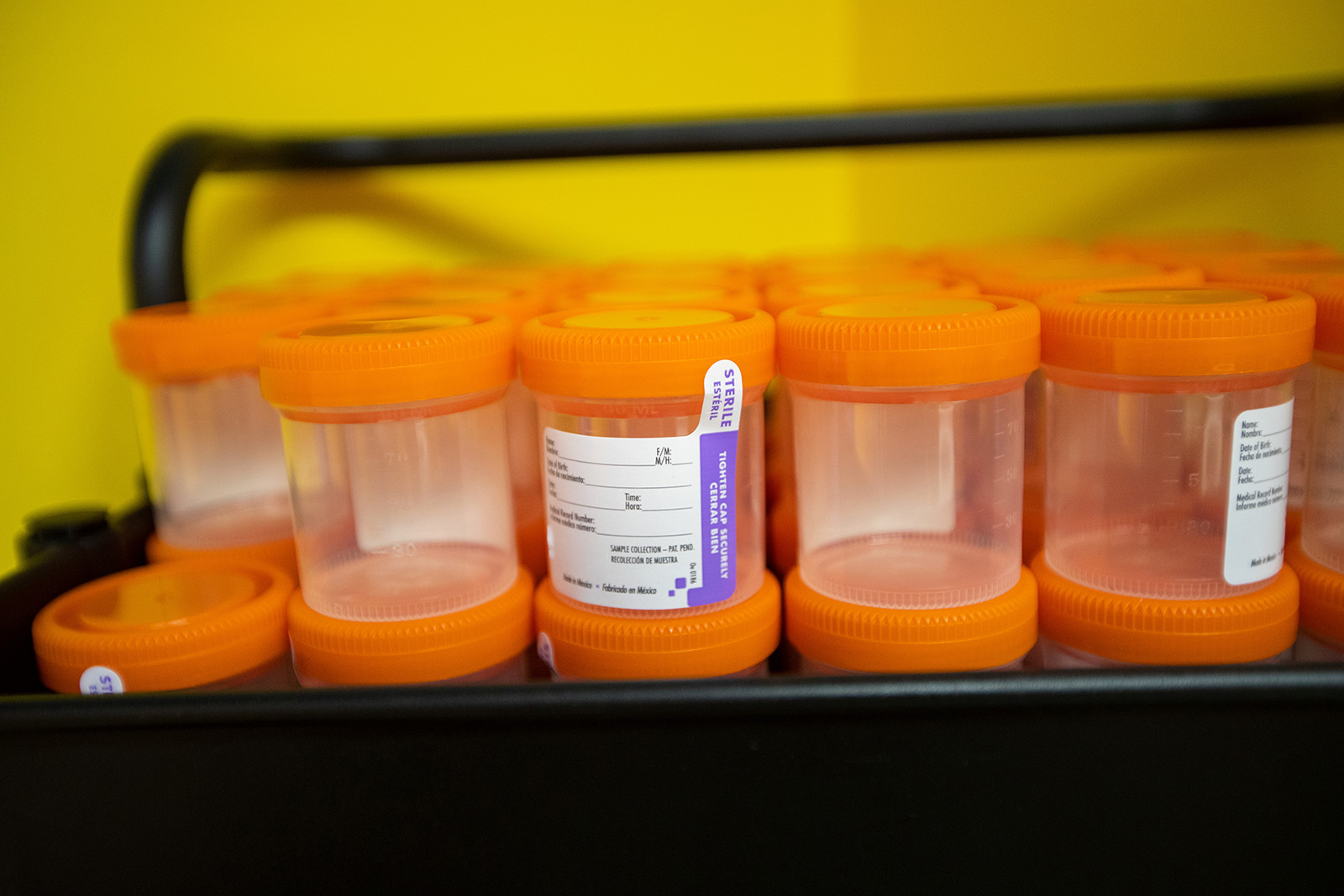 STI screenings