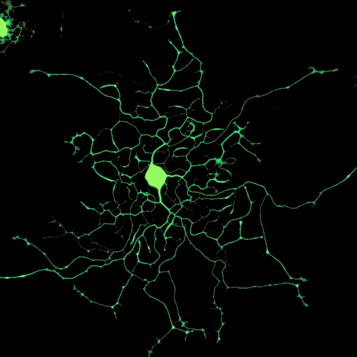 Nerve cell