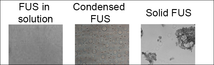 The protein FUS, from FUsed in Sarcoma, in three different phases.