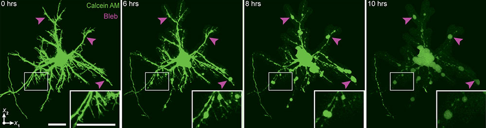 "blebs" in neural axons