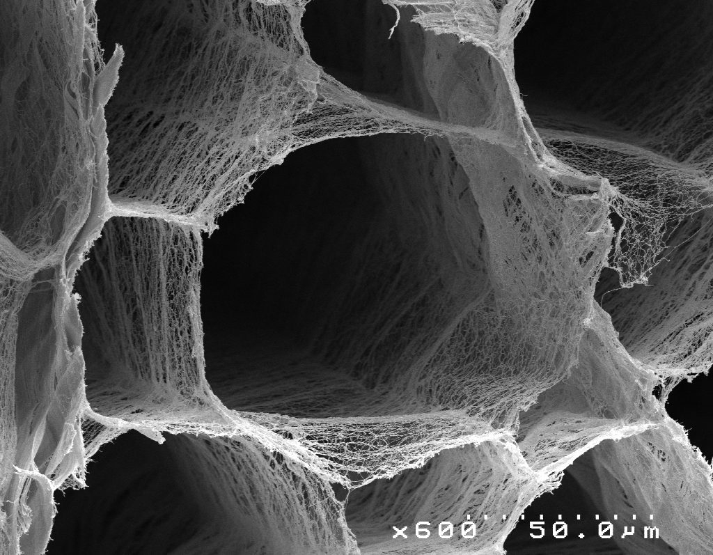 Sleboda connective tissue
