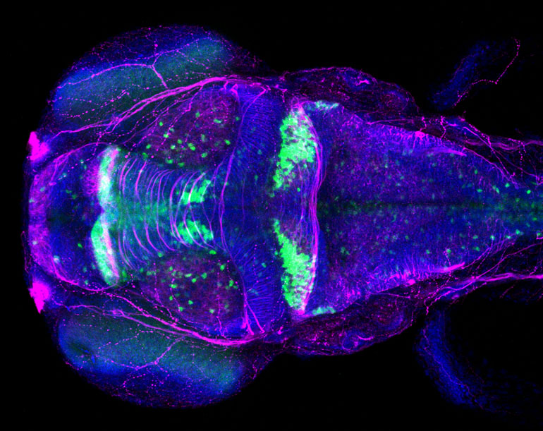 Confocal microscope image