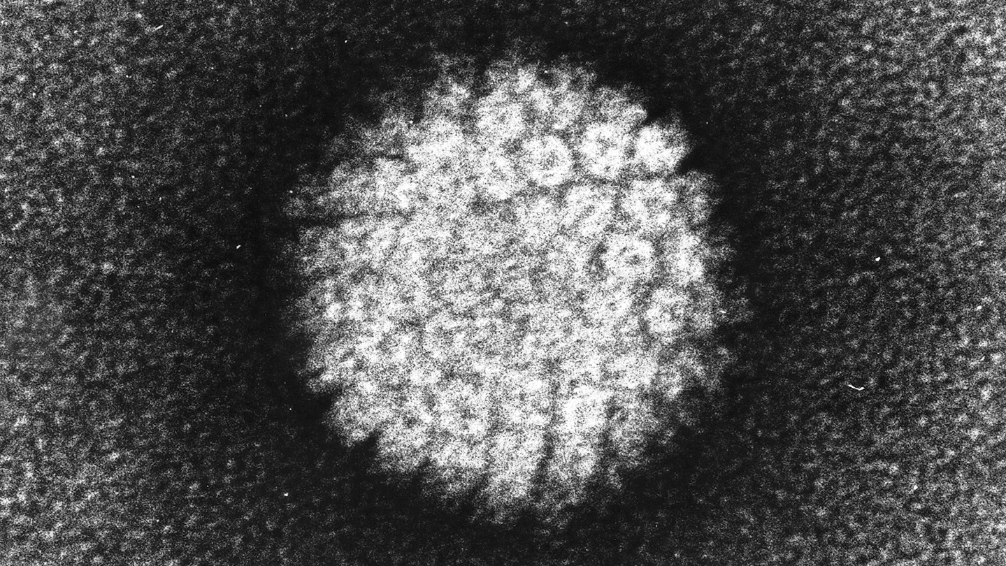 human papillomavirus colon cancer